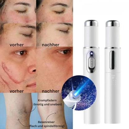 DermaBlue Pen – Blaulicht-Pen für klare, ebenmäßige & regenerierte Haut