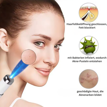 DermaBlue Pen – Blaulicht-Pen für klare, ebenmäßige & regenerierte Haut