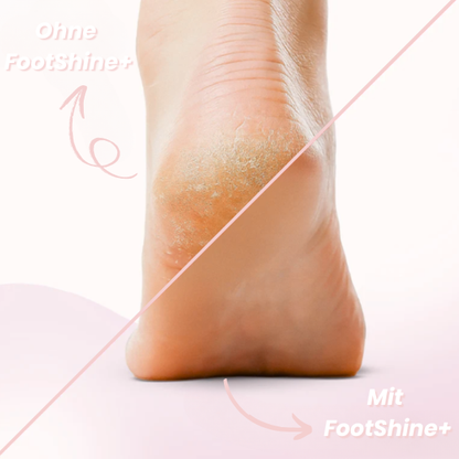 FootShine+ 2-in-1 Hornhautentferner & Pflegegerät für Füße & Hände
